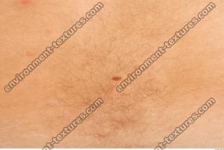 human skin hairy 0002